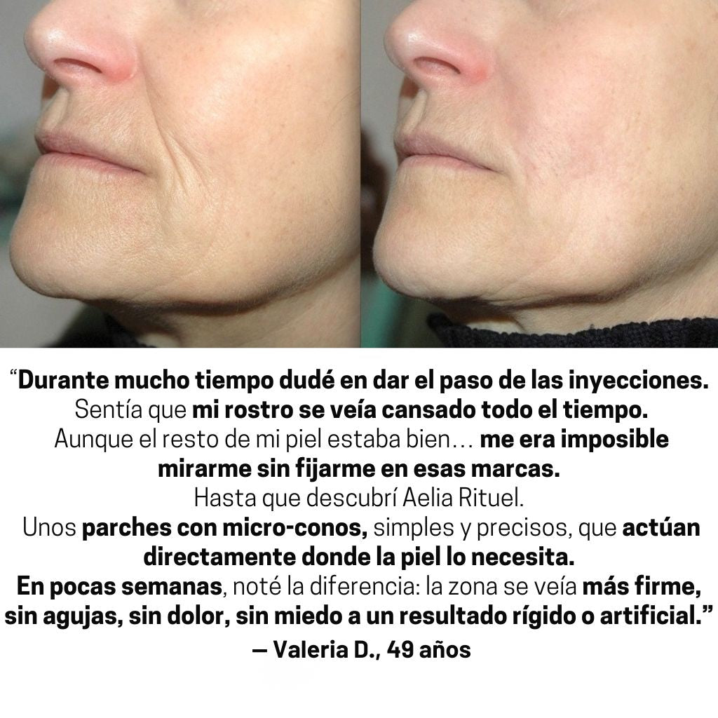 ProLift 2.0 Parche de Micro-Conos Nasogenianos