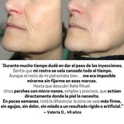 ProLift 2.0 Parche de Micro-Conos Nasogenianos