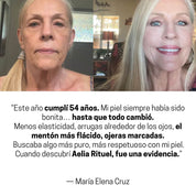ProLift 2.0 Micro-Conos para Ojos Maduros