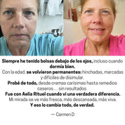 ProLift 2.0 Micro-Conos para Ojos Maduros
