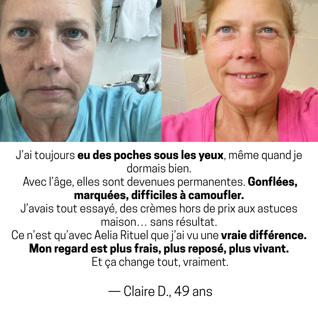 Le Patch Contour des Yeux