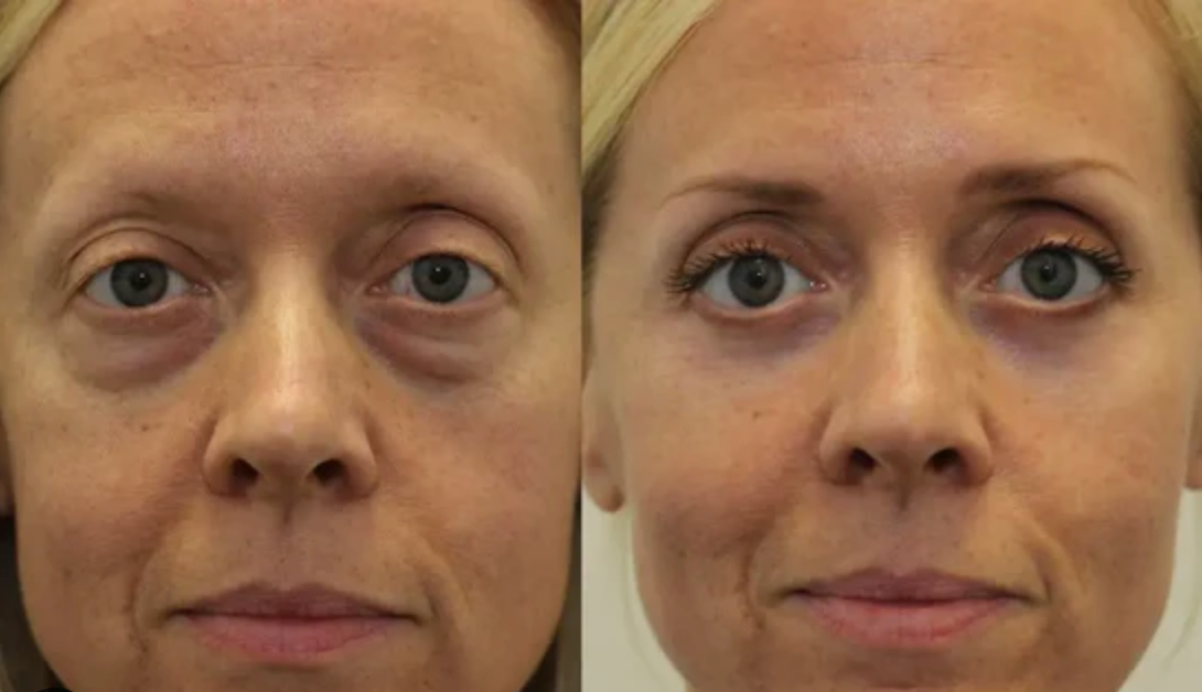 Screen Shot 2025-09-11 at 14.48.36.png__PID:370f1194-07b3-4459-8345-c7e6b67cce1d