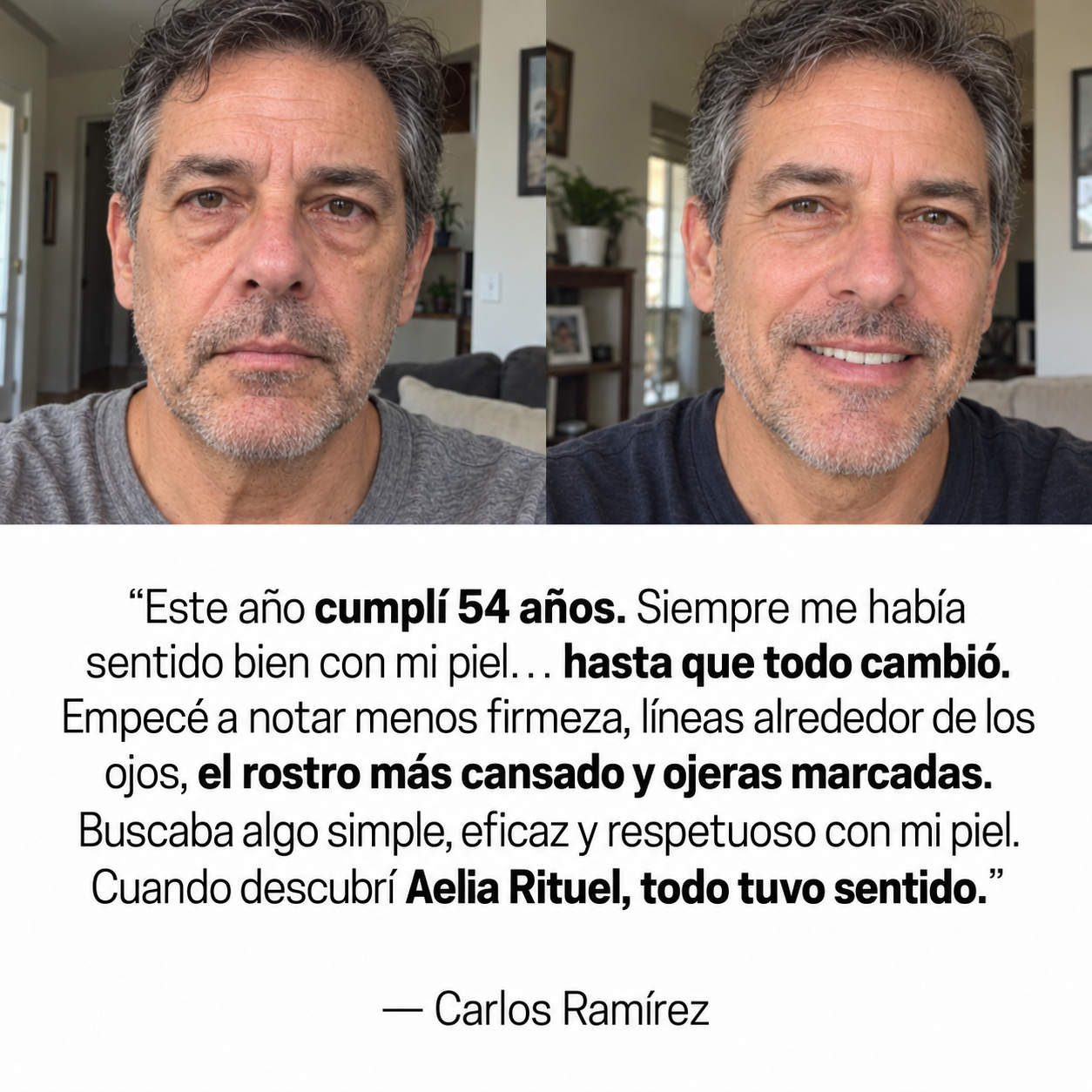 ProLift 2.0 Micro-Conos para Ojos Maduros